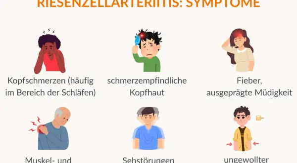 Symptome der Arteriitis temporalis: Kopfschmerzen, schmerzempfindliche Kopfhaut, Fieber, Müdigkeit, Muskel-/Gelenkschmerzen, Sehstörungen, ungewollter Gewichtsverlust.