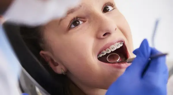 Dziewczynka z aparatem na zębach u dentysty, badanie jamy ustnej lusterkiem.