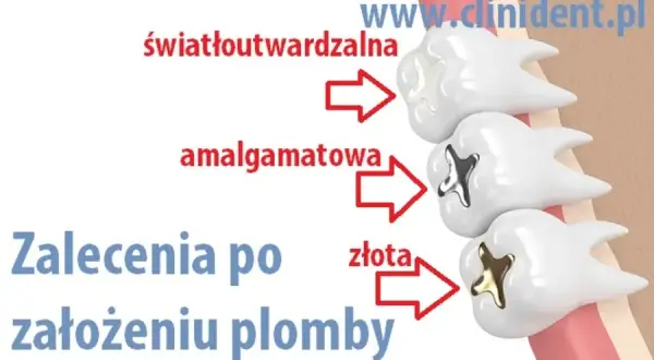 Palenie po wizycie u dentysty: Kiedy jest bezpieczne?