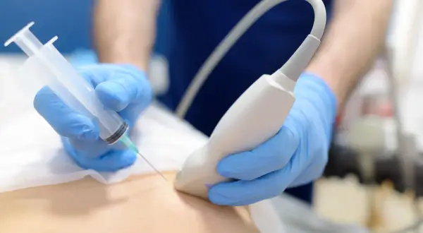 Lekarz w niebieskich rękawiczkach wykonuje biopsję mammotomiczną pod kontrolą USG.