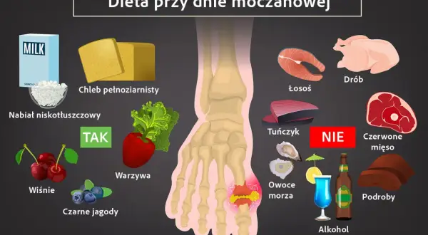 Dieta przy dnie moczanowej: nabiał, chleb pełnoziarnisty, warzywa, wiśnie, jagody - TAK. Unikaj: ryb, drobiu, czerwonego mięsa, podrobów, owoców morza, alkoholu.