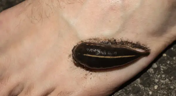 Une sangsue de rivière s'est accrochée au pied, une rencontre désagréable lors d'une baignade.