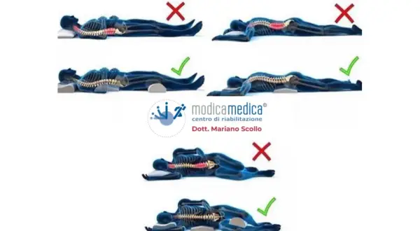Illustrazioni su come dormire con il mal di schiena: posizioni corrette e scorrette per la colonna vertebrale.