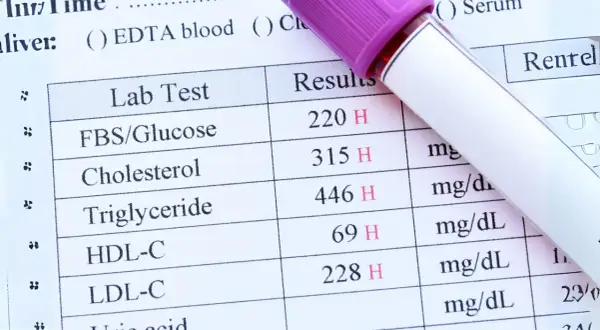 Wyniki badań krwi: glukoza, cholesterol, trójglicerydy, HDL-C, LDL-C. Szybko uzyskane dane do analizy.