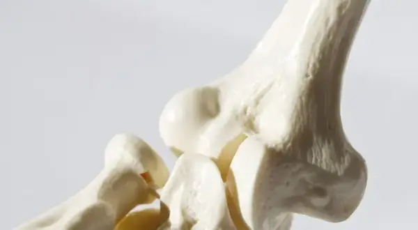 Jaki lek na osteoporozę? Poznaj skuteczne opcje leczenia i ich działanie