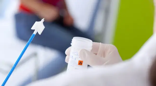 Ręka w rękawiczce trzyma pojemnik na próbkę do cytologii płynnej. W tle widać pacjentkę.