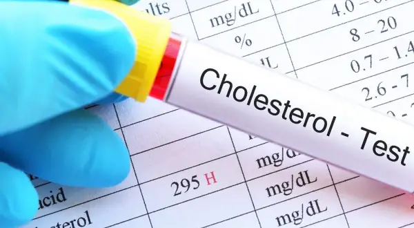 Jaki poziom cholesterolu jest odpowiedni dla wieku? Sprawdź normy i ryzyka