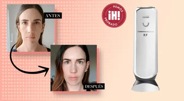 Comparativa antes y después de un tratamiento de radiofrecuencia facial. Dispositivo RF CurrentBody Skin.