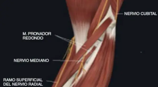 Edema muscular pronador redondo: ¿Por qué duele tu antebrazo?