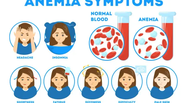 Sintomi di anemia: mal di testa, insonnia, affanno, stanchezza, vertigini, difficoltà di concentrazione, pelle pallida. Il ferro basso quando preoccuparsi è indicato da questi segnali.