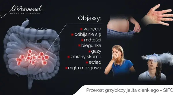 Przerost grzybiczy jelita cienkiego objawy: wzdęcia, mdłości, biegunka, gazy, zmiany skórne, mgła mózgowa.