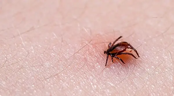 Zbliżenie na ludzką skórę z widocznym, brązowym kleszczem. Pajęczak ma osiem nóg i wyraźnie zaznaczone ciało. Wokół niego widać drobne włoski.