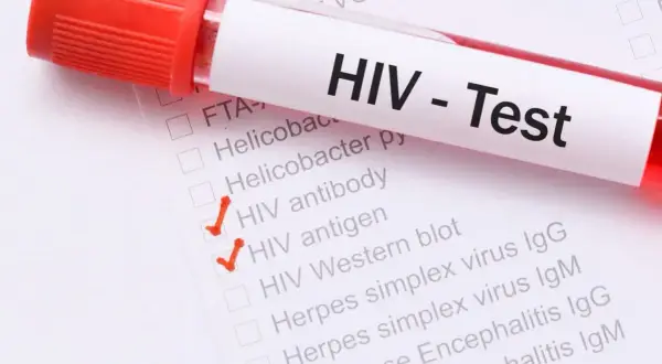 Probówka z krwią do testu HIV. Zaznaczone opcje: przeciwciała HIV i antygen HIV.