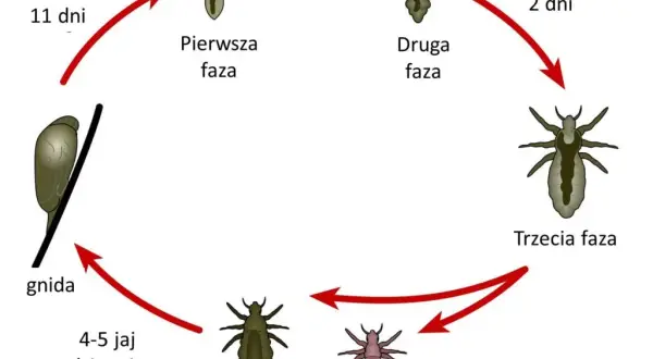 Jak rozmnażają się wszy? Cykl życia i jak go przerwać