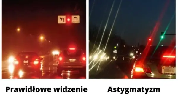 Astygmatyzm: czy można go wyleczyć? Poznaj metody korekcji