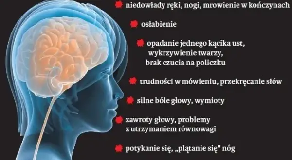 Zmiany malacyjne w mózgu objawy – jak je rozpoznać i co oznaczają?