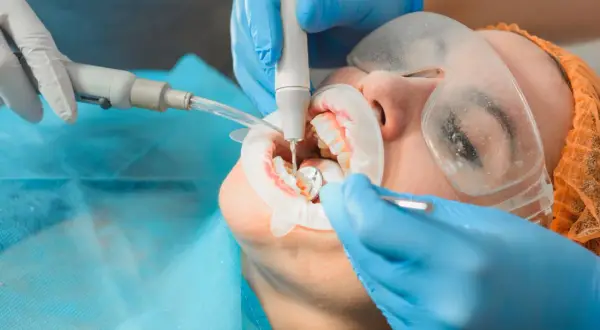 Dentysta wykonuje zabieg higienizacji zębów, usuwając kamień ultradźwiękami. Pacjent ma założony retraktor i okulary ochronne.