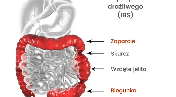 Syndrom Habba: Objawy, które mylisz z IBS. Jak rozpoznać i leczyć?