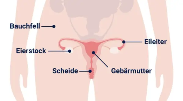 Anatomische Darstellung des weiblichen Beckens mit Gebärmutter, Eierstöcken und Eileitern. Informationen zu Eierstockkrebs, woran stirbt man, sind hier nicht ersichtlich.