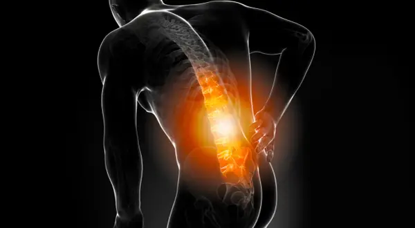 Schmerzende Wirbelsäule, die auf Osteochondrose hinweist. Ein Mann hält sich den Rücken, wo die Knochen rot glühen.