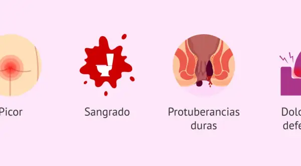 Síntomas de hemorroides postparto: picor, sangrado, protuberancias duras y dolor al defecar.