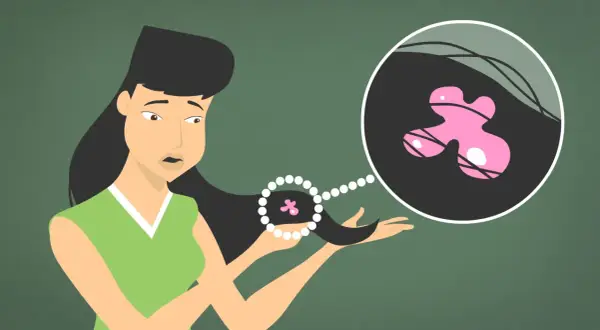Une femme découvre une masse rose ressemblant à du chewing-gum emmêlée dans ses cheveux.