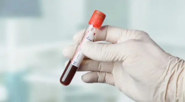 Gazometria: Co to za badanie? Zrozum wyniki i nie bój się pobrania