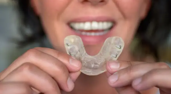 Una persona mostra un bite dentale trasparente, utile per chi tende a sbattere i denti mentre si dorme.