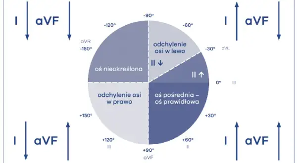 Lewogram patologiczny EKG: Co to znaczy? Przyczyny i co dalej