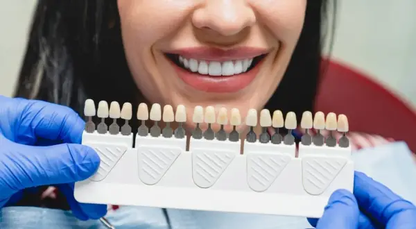Uśmiechnięta kobieta z idealnymi zębami, dentysta dobiera odcień licówek. Dowiedz się, ile kosztują licówki na wszystkie zęby.