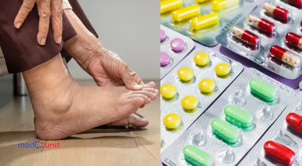 Dna moczanowa: Szybka ulga bez recepty i kiedy iść do lekarza?