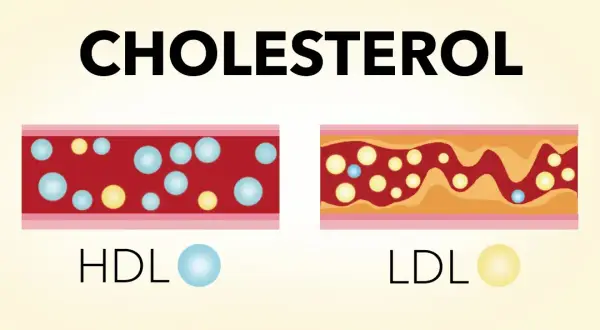 Jak obniżyć cholesterol przy izoteku i uniknąć zdrowotnych zagrożeń