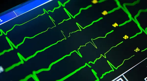 Zielone linie na czarnym ekranie pokazują zapis ekg serca, analizę pracy serca.