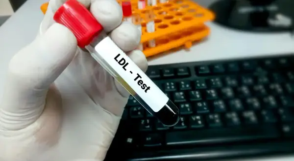 Jak bezpiecznie podnieść cholesterol? Sprawdź skuteczne metody i porady
