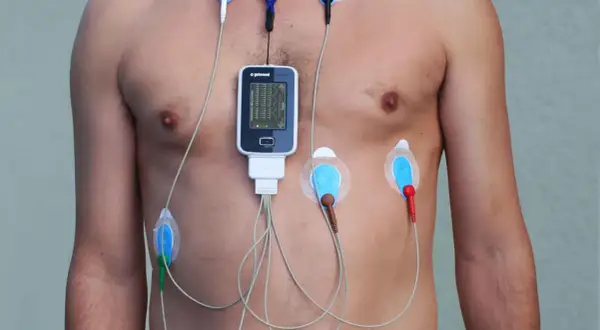 Czy Holter wykryje nerwicę? Ograniczenia badania EKG w diagnozie