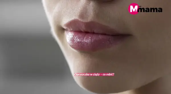 Zbliżenie na usta kobiety z widoczną opryszczką. Tekst informuje o przyczynach opryszczki na ustach i sposobach radzenia sobie z nią w ciąży.