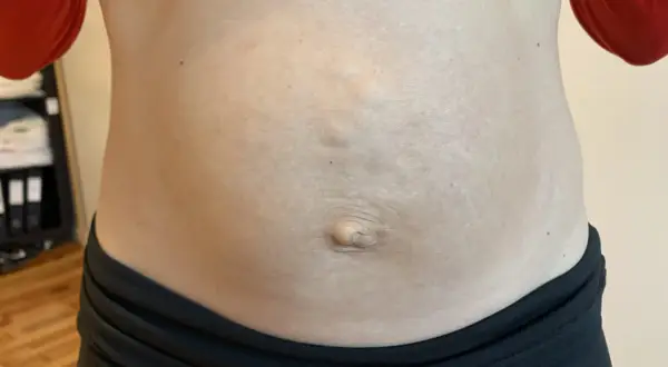 En mage med synliga delade magmuskler och navel.