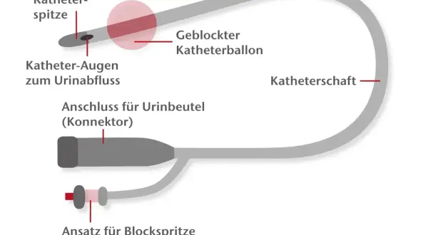 Schema eines Katheters für den Mann: Nélaton-Spitze, Ballon, Anschluss für Urinbeutel und Ansatz für Blockspritze.