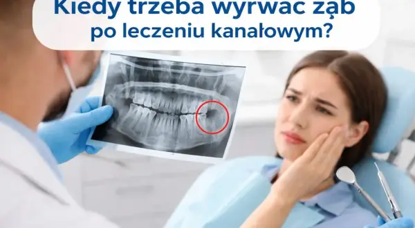 Dentysta pokazuje pacjentce prześwietlenie zęba, wskazując na problem. Kiedy trzeba rozważyć usuwanie zębów leczonych kanałowo?
