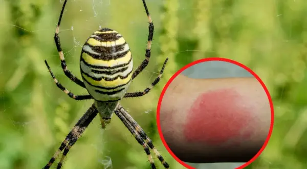 Tygrzyk paskowany na sieci, obok zaczerwieniona skóra po ugryzieniu.
