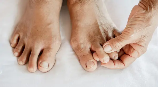 Nahaufnahme von Füßen mit Hammerzehen. Eine Hand berührt sanft die Zehen, die eine gekrümmte Form aufweisen.