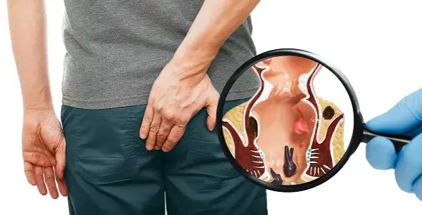 Nie wstydź się! Proktolog: Kiedy iść i jak wygląda wizyta?
