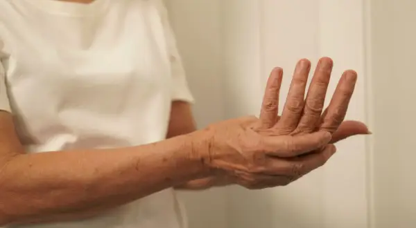 Dłoń z widocznymi zmarszczkami i przebarwieniami, palce lekko zgięte, sugerujące uczucie mrowienia lub drętwienia – **parestezja**.