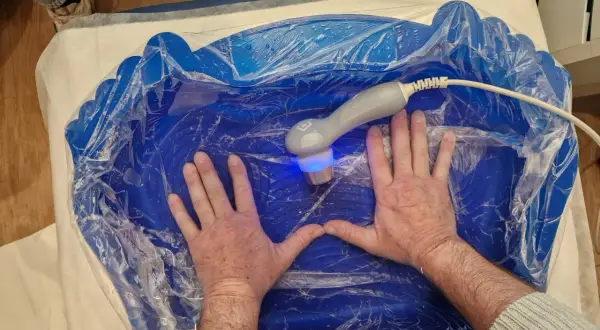 Mani immerse in un bagno blu per ultrasuoni in acqua per piedi, con un manipolo che emette luce blu.