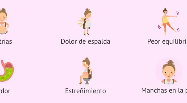 Ilustraciones de síntomas comunes en la semana 24 de embarazo: estrías, dolor de espalda, peor equilibrio, ardor, estreñimiento y manchas en la piel.