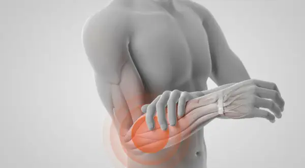 En man håller sin armbåge där muskler underarm visas med smärtcirklar.