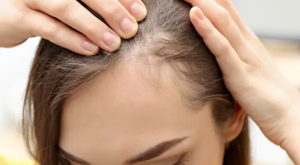 Dłonie kobiety delikatnie dotykają jej skroni, ukazując cienkie, jasne włoski, przypominające baby hair.