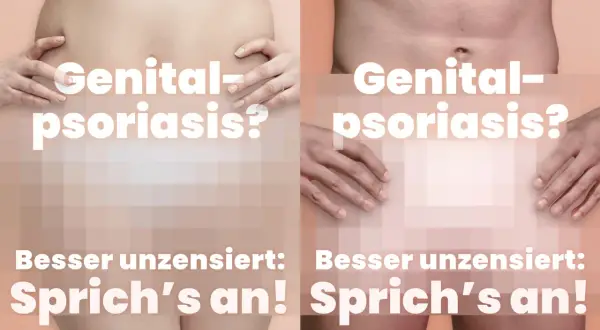 Genital-Psoriasis? Zwei Körper zeigen, dass es besser ist, offen darüber zu sprechen.