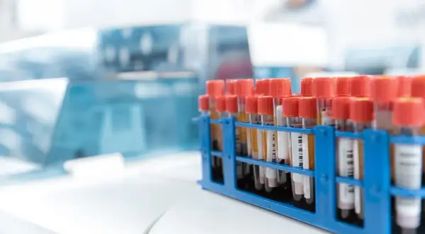 Badania hematologiczne: Co to jest i co mówią o Twoim zdrowiu?