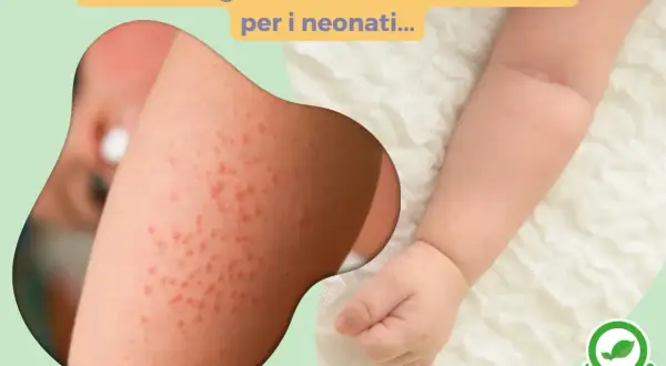 Pelle irritata di un neonato. Scopri come lavare i vestiti dei neonati in lavatrice con detergenti naturali per evitare arrossamenti.